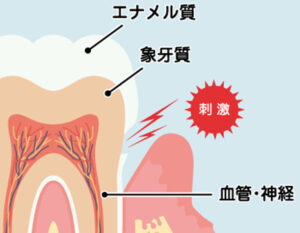 大島・東大島の歯医者、あおぞら歯科で、下がった歯ぐきに行う根面被覆についての解説