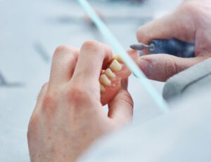 大島・東大島の歯医者、あおぞら歯科で、頬の内側を噛んでしまう原因と対処法についての解説