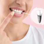 大島・東大島の歯医者、あおぞら歯科で、インプラントのメンテナンス頻度と長持ちさせる秘訣を解説