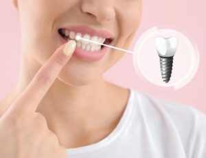 大島・東大島の歯医者、あおぞら歯科で、インプラントのメンテナンス頻度と長持ちさせる秘訣を解説