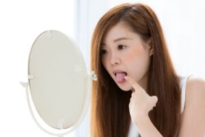 江東区大島・東大島の歯医者、あおぞら歯科で、舌の表面が白くなっているのは病気？口臭の原因にもなる「舌苔」について解説