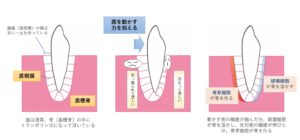 大島・東大島の歯医者、あおぞら歯科で、矯正治療で歯が動くときの「むずがゆい」感覚の正体は？歯周組織の変化と違和感への対処法を解説